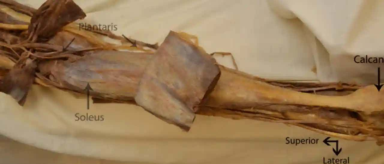 The soleus on the tibia