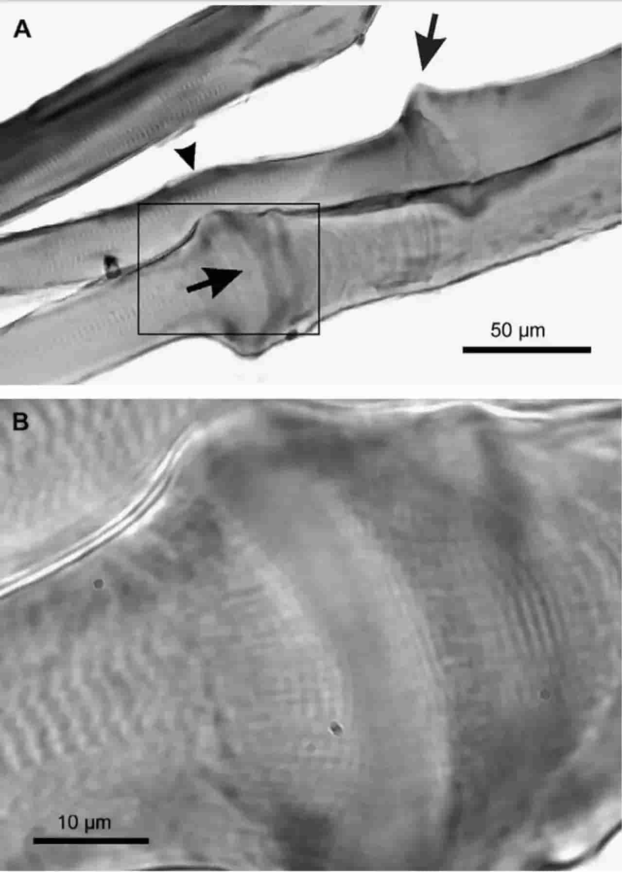 A close up view of the contractile disks in a muscle