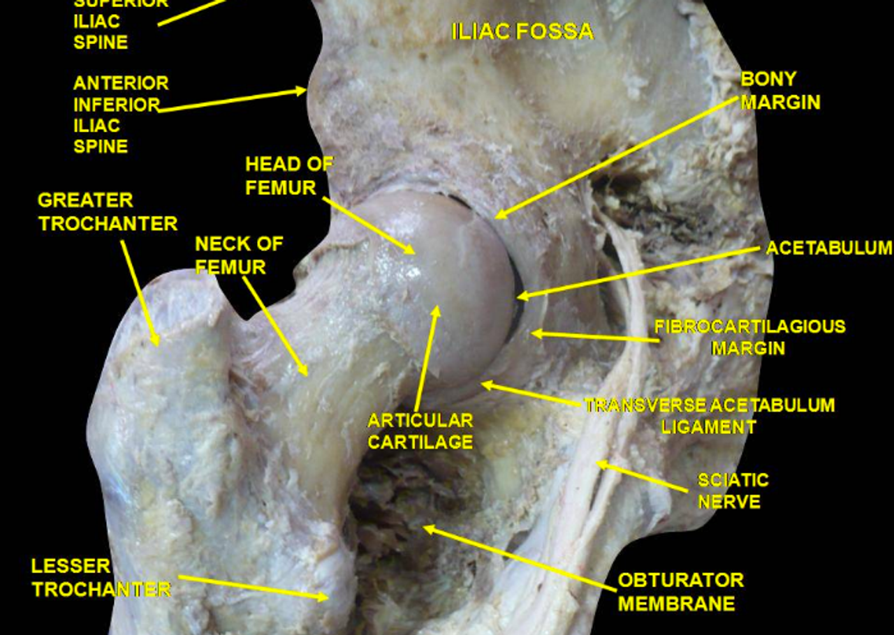 Cadaver photo of the acetabulum of the pelvis and femur connecting to form the hip joint. Text and arrows on the image in yellow labeling the boney landmarks, ligaments, bursae, and sciatic nerve