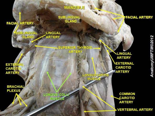 Cadaver Dissection reveiling the anterior side of the cervical spine with clear depiction of the deep neck flexors (longus colli and longus capitis)