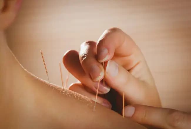 Negative messaging and patient expectation may increase the pain felt during acupuncture, but is unlikely to have a significant effect on outcomes.