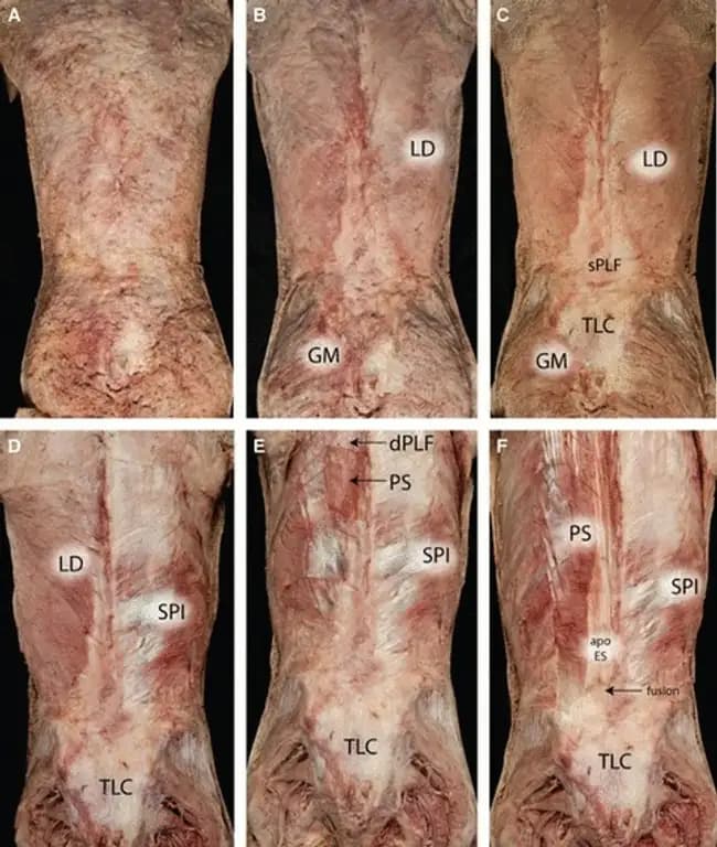 Image of the thoracolumbar fascia and attachments into various muscles.