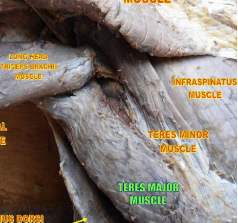 Teres major muscle highlighted in a cadaver dissection