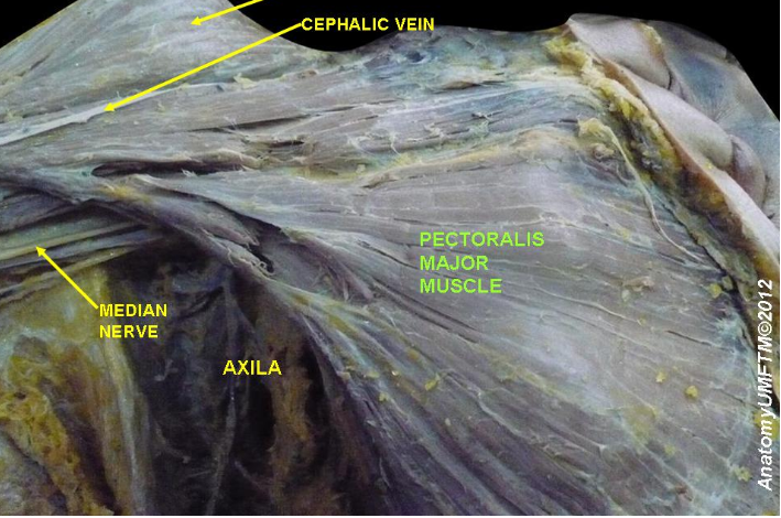 Dissection of the pectoralis major muscle 