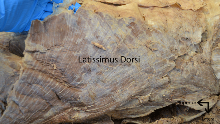 Latissimus dorsi in a cadaver dissection of the torso