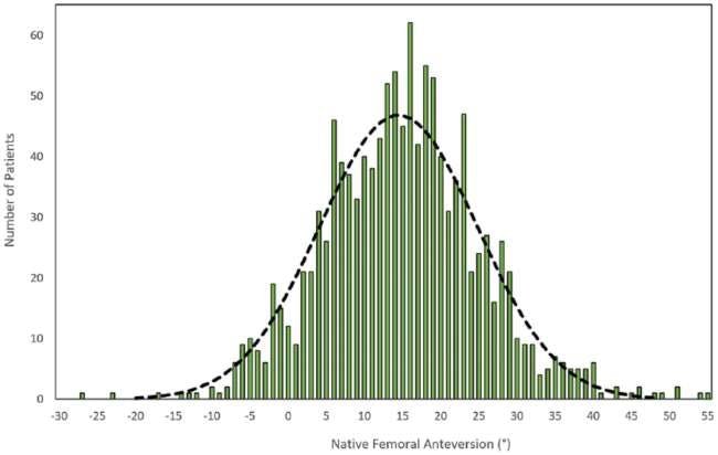 Bell curve distruction of findings from Pierrepont, J. W., Marel, E., Bar&eacute;, J. V., Walter, L. R., Stambouzou, C. Z., Solomon, M. I., ... &amp; Shimmin, A. J. (2020). Variation in femoral anteversion in patients requiring total hip replacement.&nbsp;HIP International,&nbsp;30(3), 281-287.