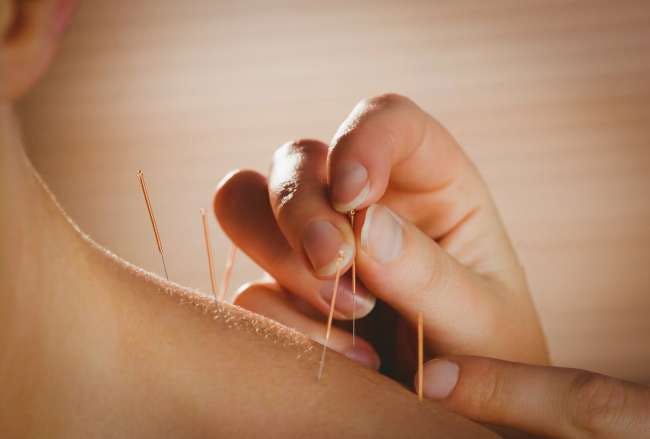 Negative messaging and patient expectation may increase the pain felt during acupuncture, but is unlikely to have a significant effect on outcomes.
