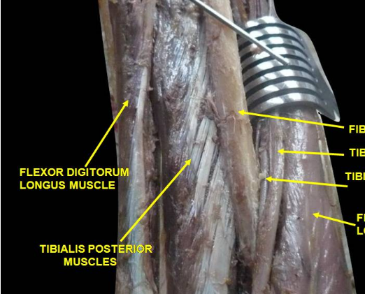 Tibialis posterior in a cadaver dissection