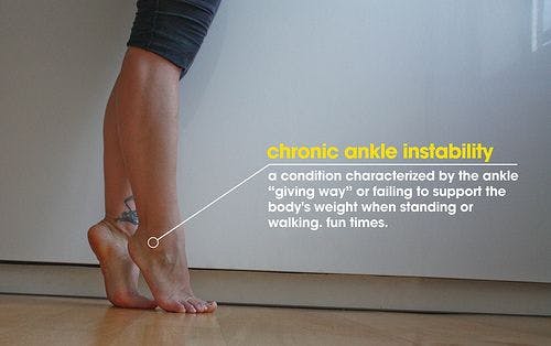 Image of a dancer&#39;s lower leg with ankle plantar flexed, including a label of chronic ankle instability.