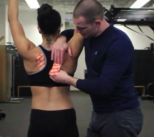Dr. Brookbush applies Kinesiology Tape to the Lower Trapezius for reinforcement of activation exercises done during treatment.