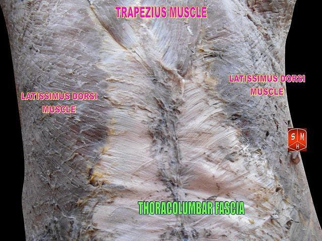 Thoracolumbar fascia. Notice the lighter colored band of tissue. This is the fascia.