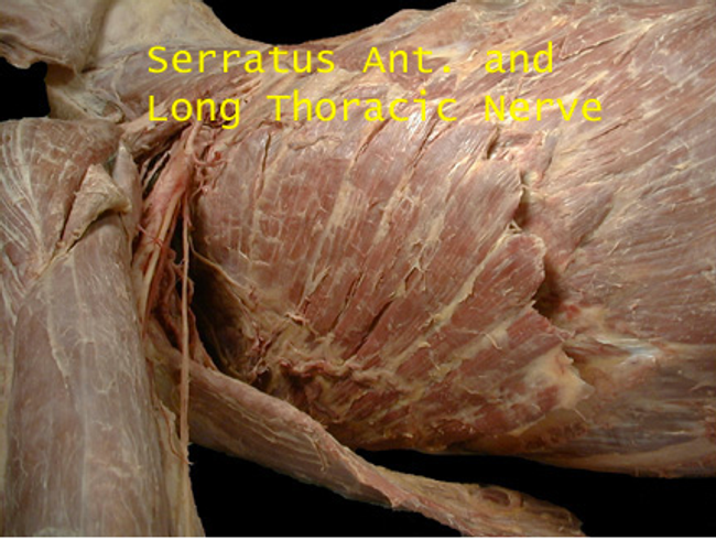 The serratus anterior in a cadaver dissection