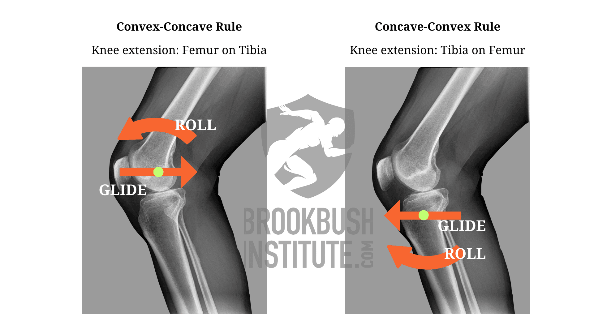 Convex-Concave Rule (and concave-convex rule) - Glossary Term Convex-Concave Rule (and concave-convex rule) - Glossary Term Illustration