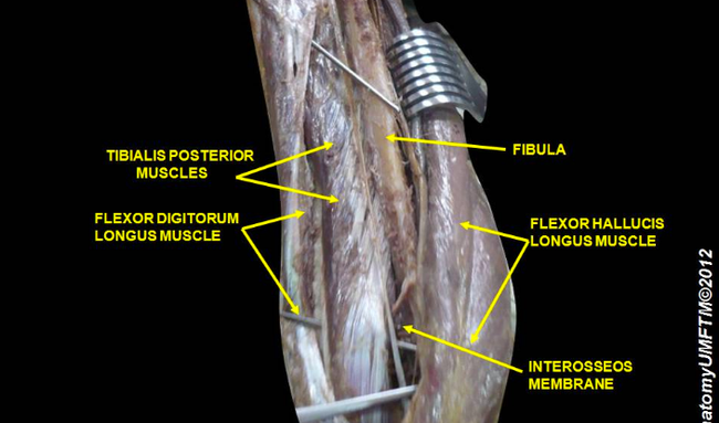 Cadaver Disscection of the Flexor Hallucis Longus and Flexor Digitorum Longus 
