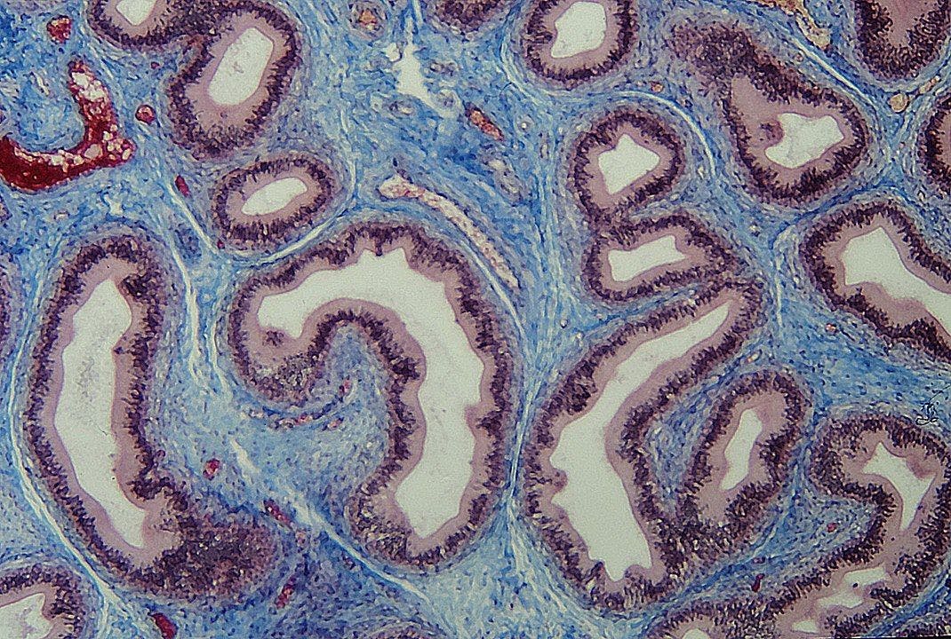 Connective Tissue Cell Thumbnail