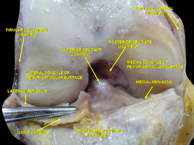 The knee joint bones, ligaments, and connective tissue