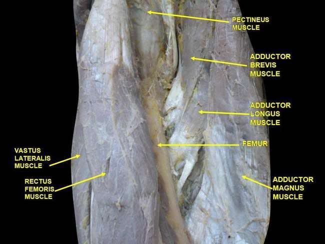 Hip adductor muscles in a cadaver: pectineus, adductor brevis, adductor longus, adductor magnus, and gracilis