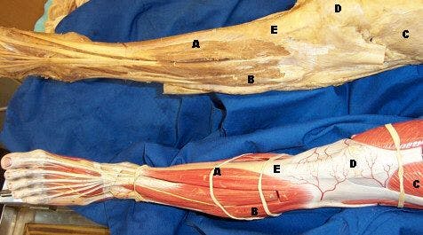 The tibialis anterior running from the tibia to the foot