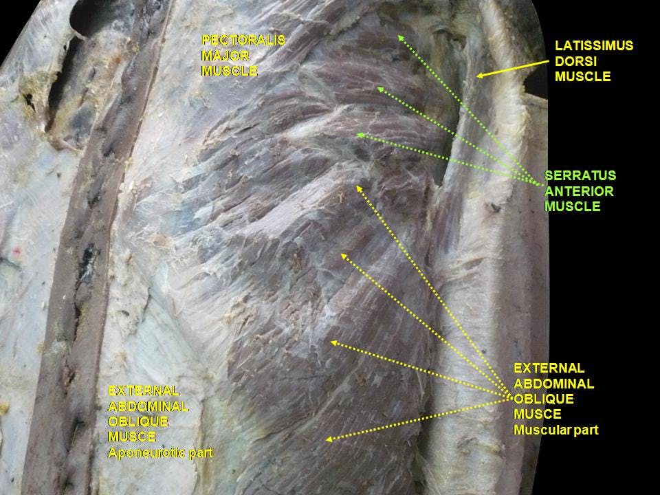 Cadaver image of the serratus anterior&#39;s origin