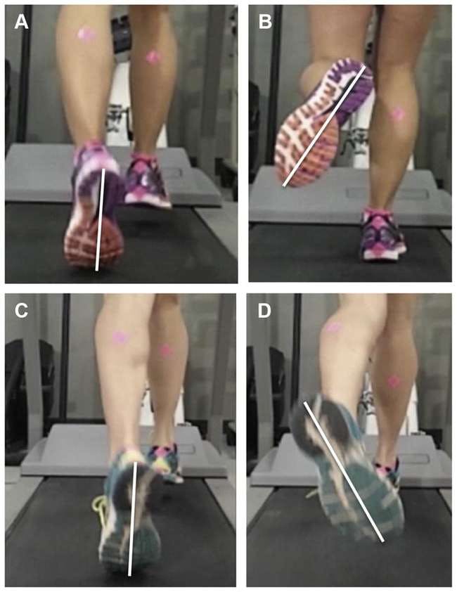 Medial and lateral heel whip during running